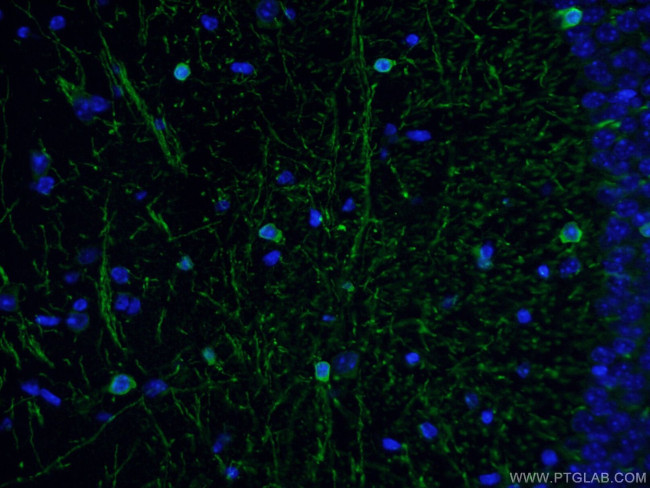 CNPase Antibody in Immunohistochemistry (PFA fixed) (IHC (PFA))