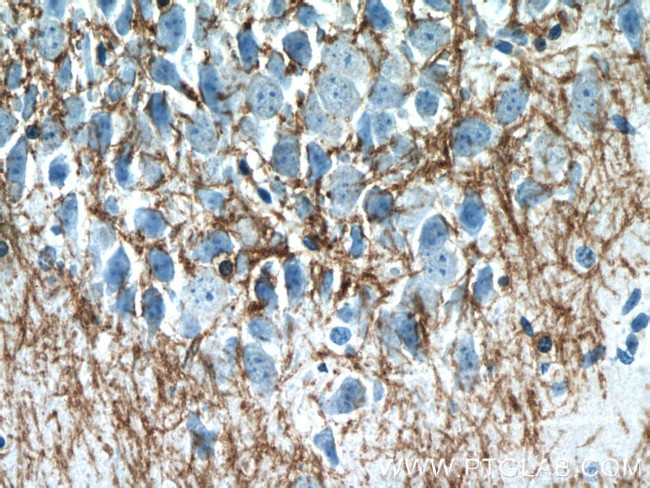 CNPase Antibody in Immunohistochemistry (Paraffin) (IHC (P))