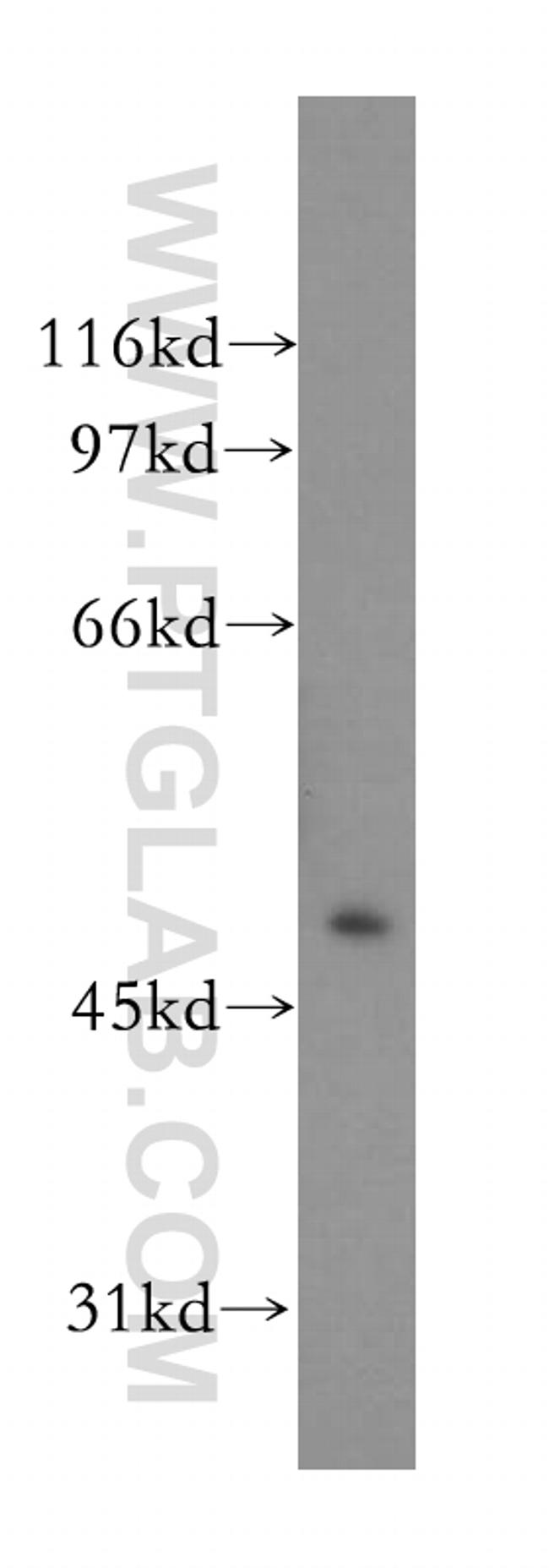 CNPase Antibody in Western Blot (WB)