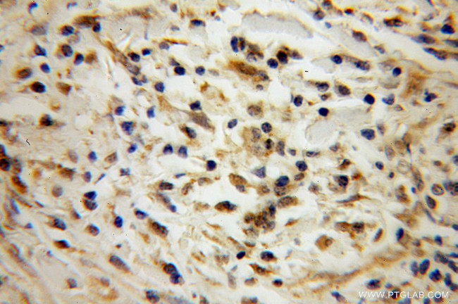 POLR2C Antibody in Immunohistochemistry (Paraffin) (IHC (P))