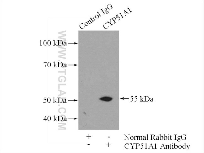 CYP51A1 Antibody in Immunoprecipitation (IP)