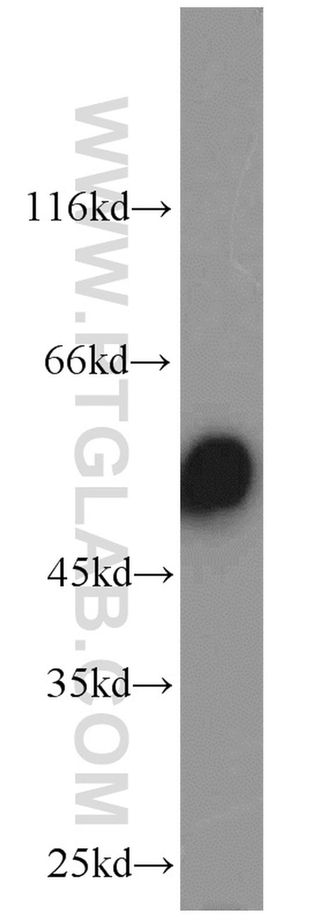 CYP51A1 Antibody in Western Blot (WB)