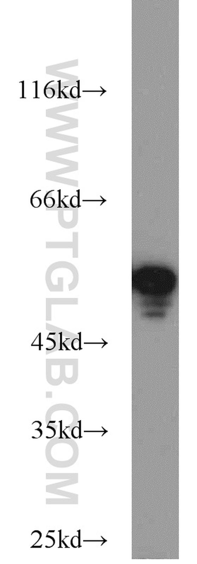 CYP51A1 Antibody in Western Blot (WB)