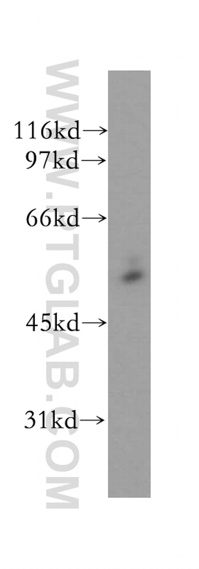 CYP51A1 Antibody in Western Blot (WB)