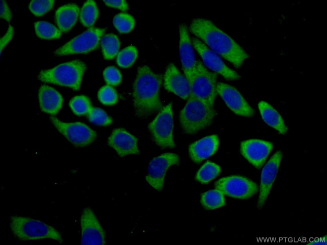 MTUS1 Antibody in Immunocytochemistry (ICC/IF)