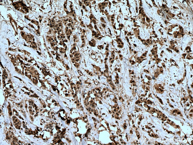 MTUS1 Antibody in Immunohistochemistry (Paraffin) (IHC (P))