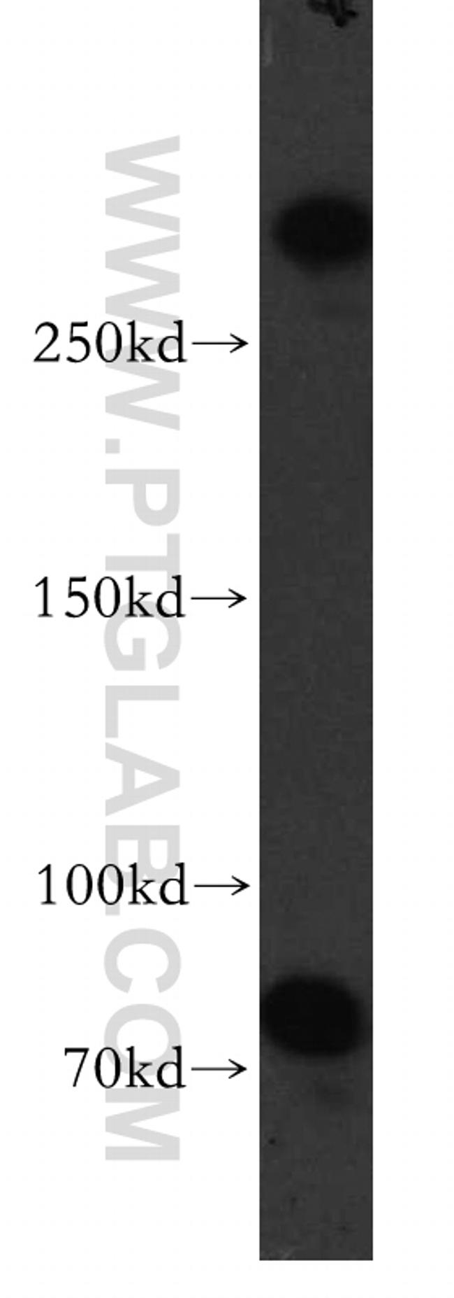 MTUS1 Antibody in Western Blot (WB)