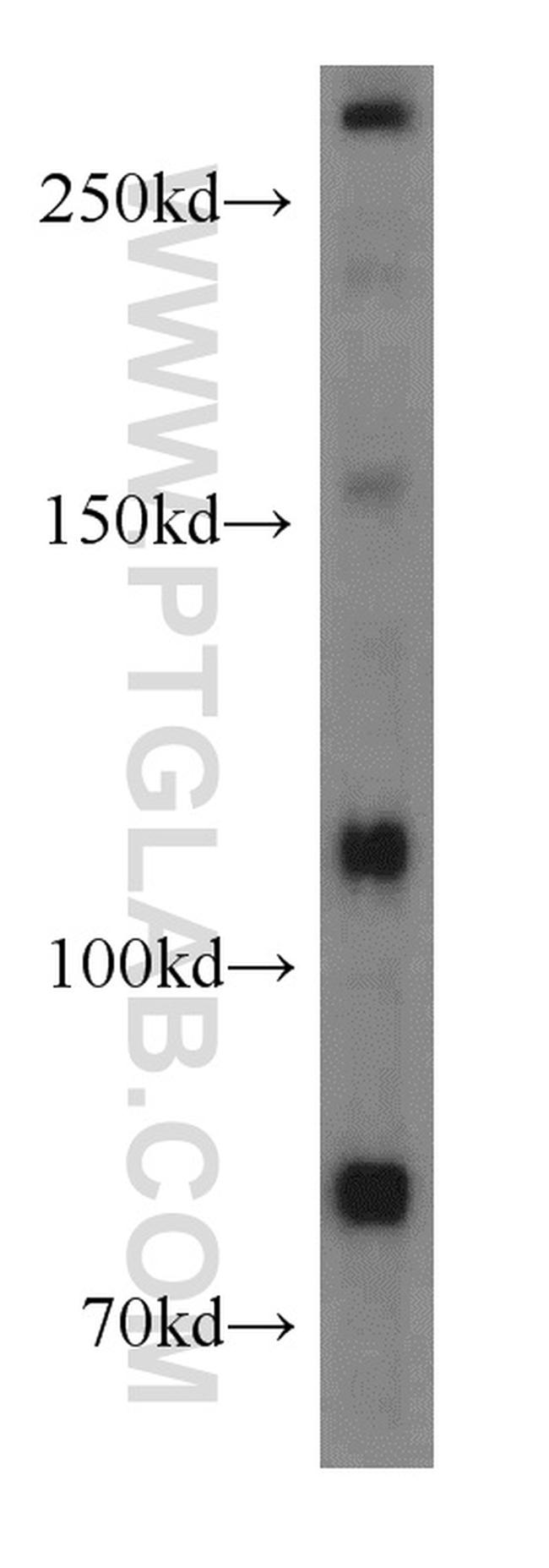 MTUS1 Antibody in Western Blot (WB)