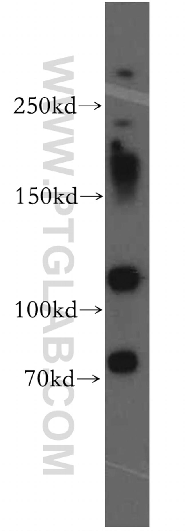 MTUS1 Antibody in Western Blot (WB)