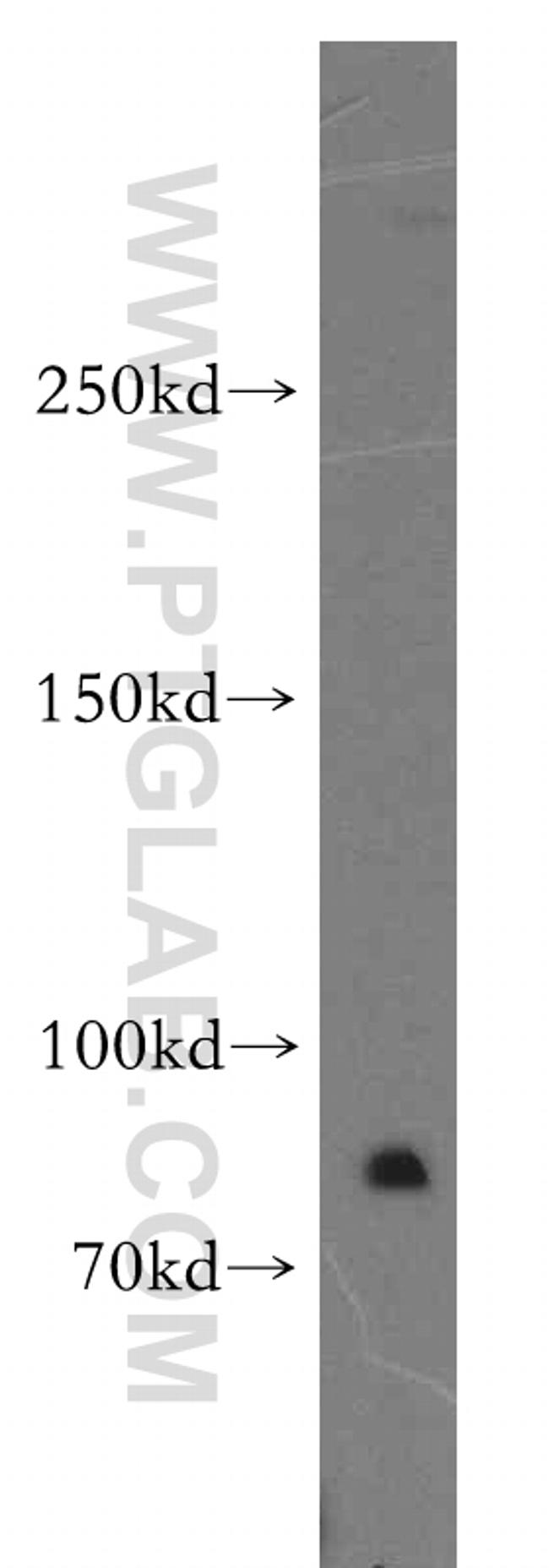 MTUS1 Antibody in Western Blot (WB)