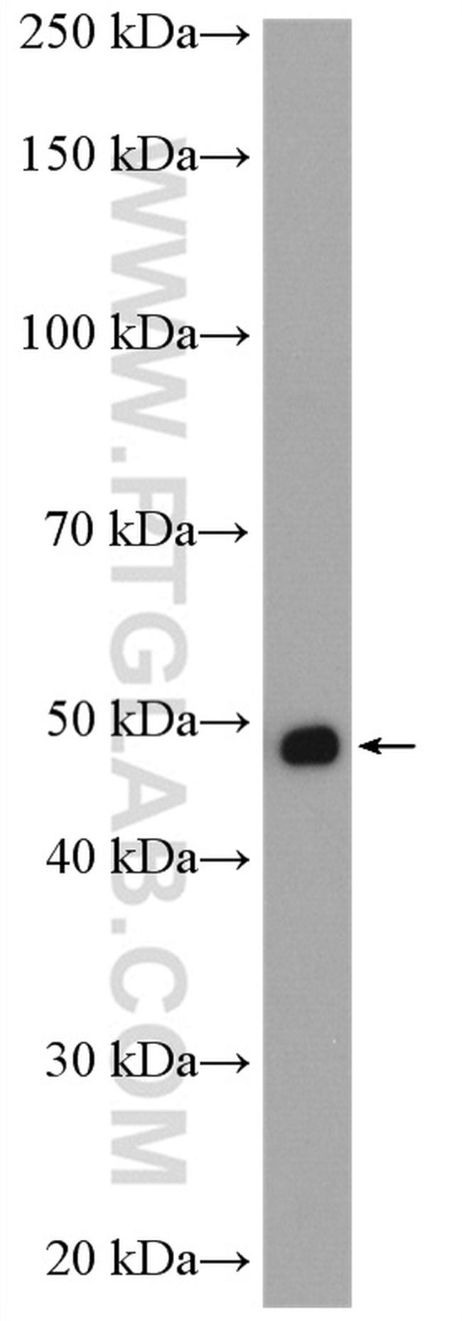 MTUS1 Antibody in Western Blot (WB)