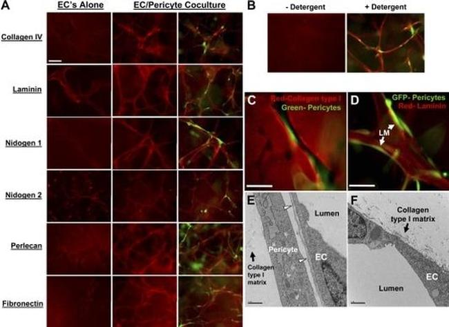 Perlecan Antibody in Immunohistochemistry (IHC)