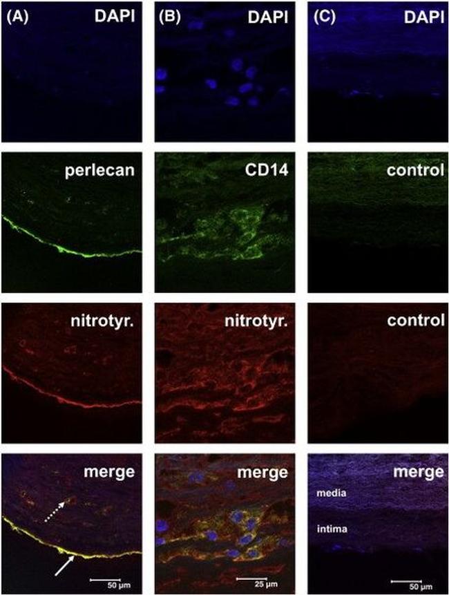 Perlecan Antibody in Immunohistochemistry (IHC)