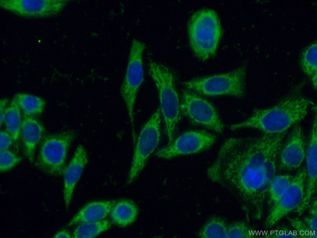 NNT Antibody in Immunocytochemistry (ICC/IF)