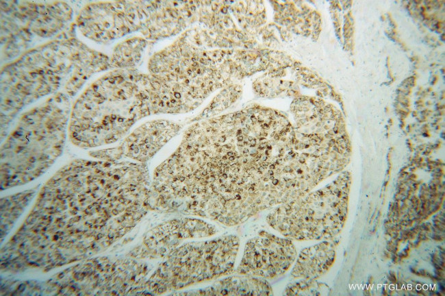 NNT Antibody in Immunohistochemistry (Paraffin) (IHC (P))