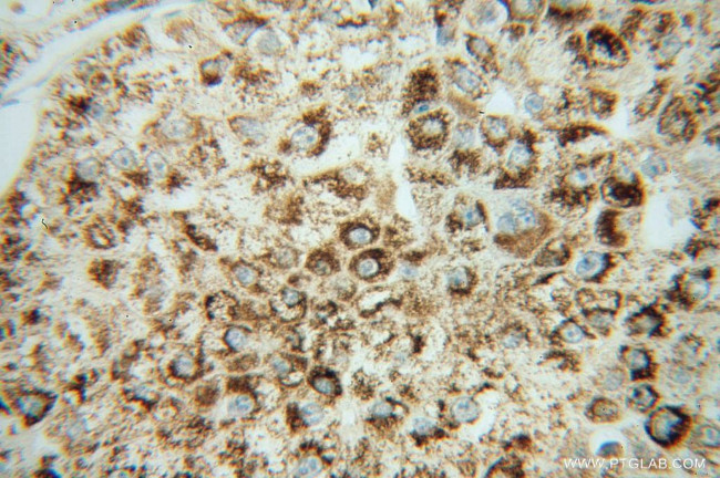 NNT Antibody in Immunohistochemistry (Paraffin) (IHC (P))