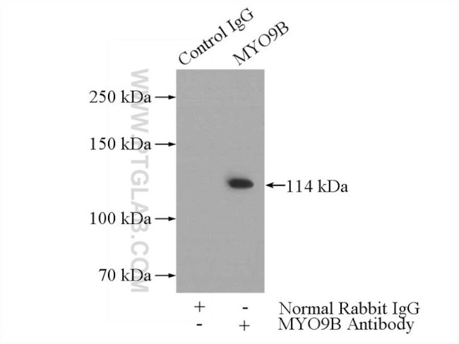 NNT Antibody in Immunoprecipitation (IP)