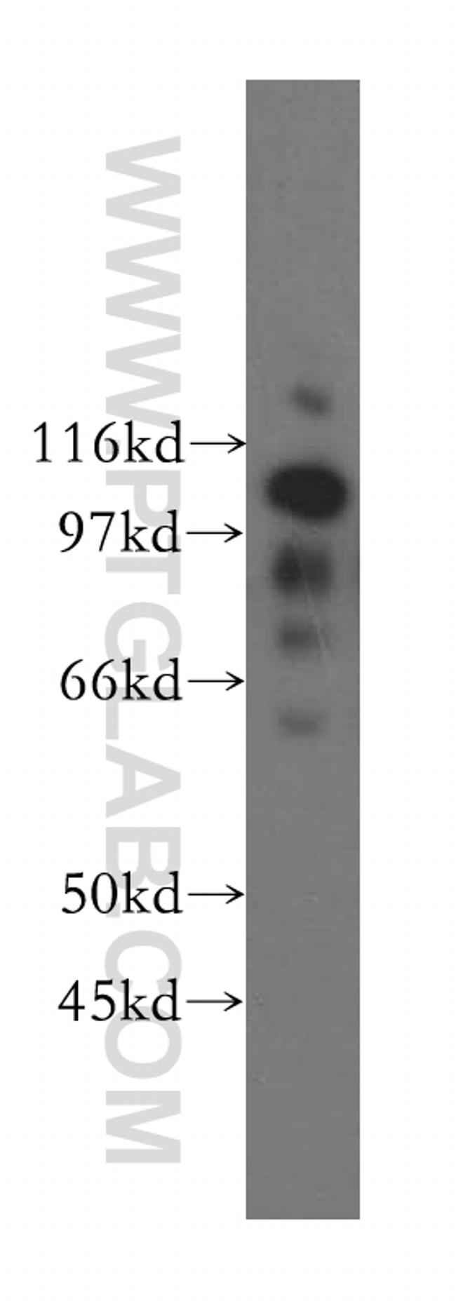 NNT Antibody in Western Blot (WB)