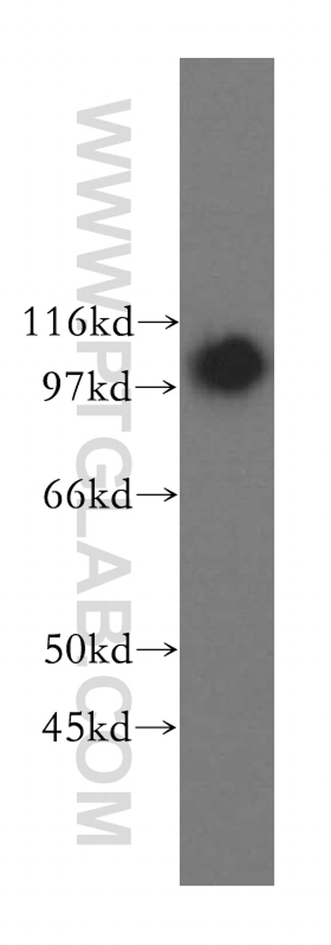 NNT Antibody in Western Blot (WB)