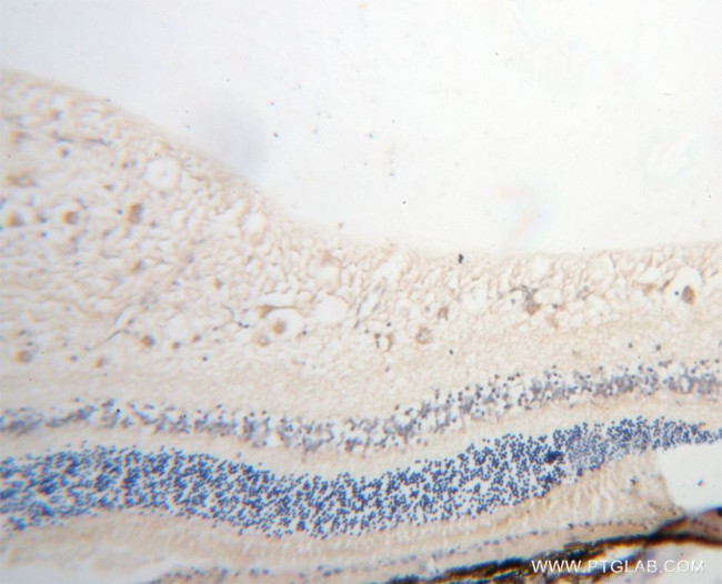 KCNS2 Antibody in Immunohistochemistry (Paraffin) (IHC (P))