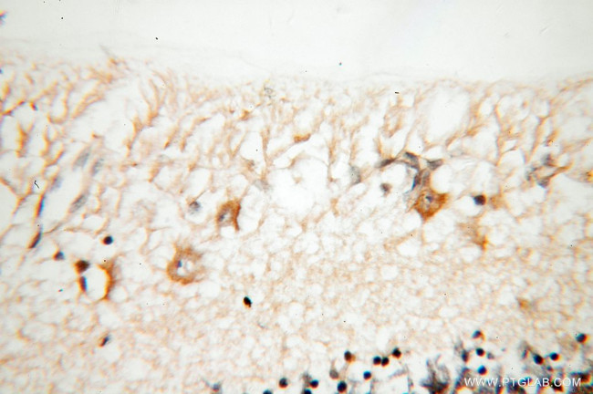 KCNS2 Antibody in Immunohistochemistry (Paraffin) (IHC (P))