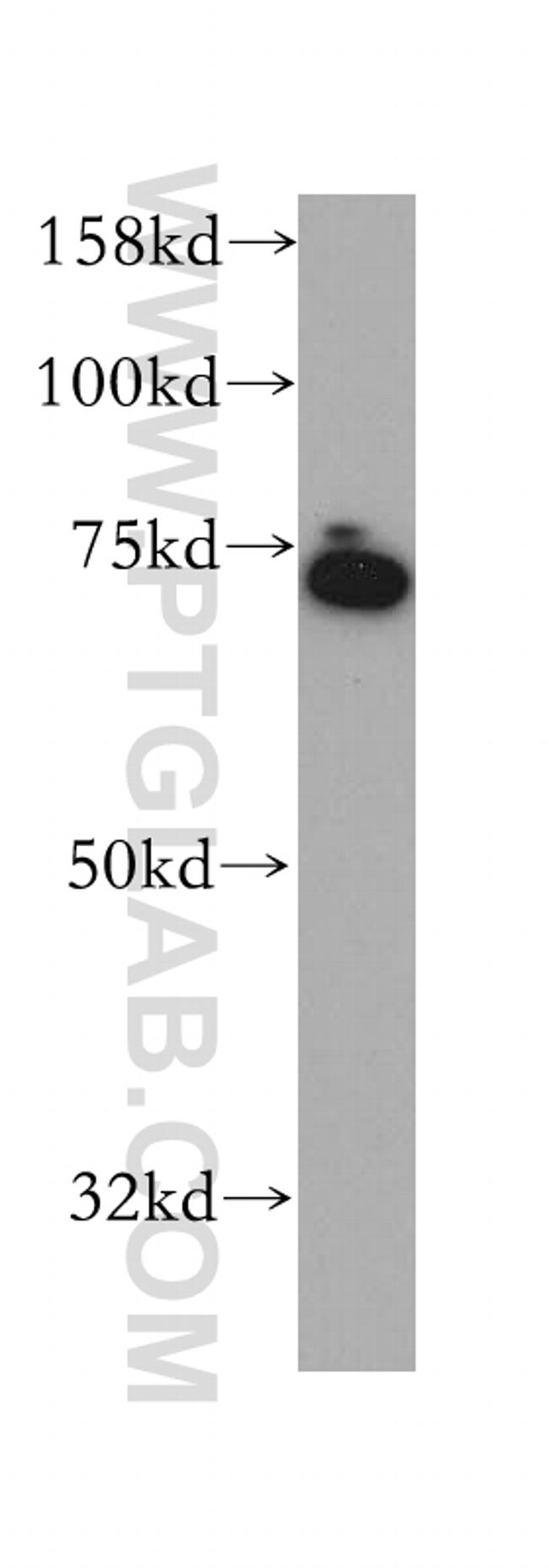 KCNS2 Antibody in Western Blot (WB)