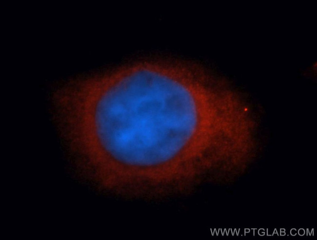 DVL3 Antibody in Immunocytochemistry (ICC/IF)