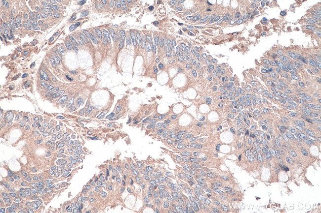 DVL3 Antibody in Immunohistochemistry (Paraffin) (IHC (P))