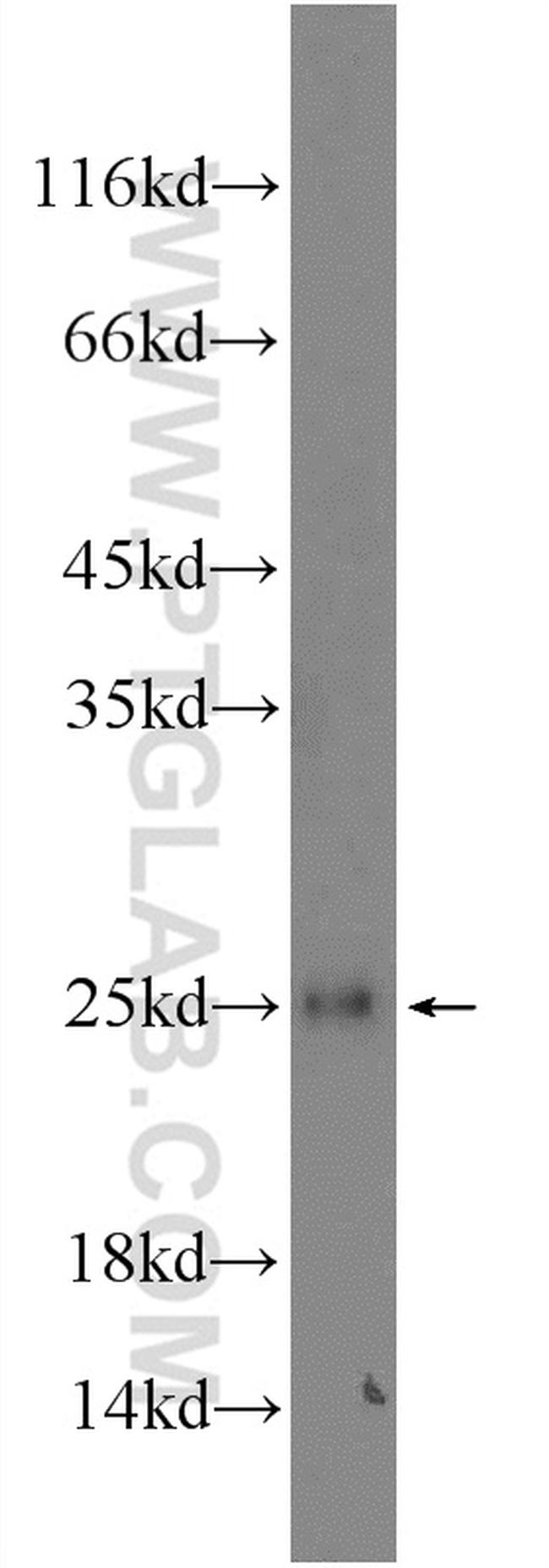 GCET2 Antibody in Western Blot (WB)