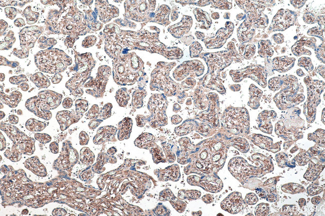 PDGFRB Antibody in Immunohistochemistry (Paraffin) (IHC (P))