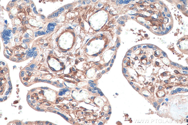 PDGFRB Antibody in Immunohistochemistry (Paraffin) (IHC (P))