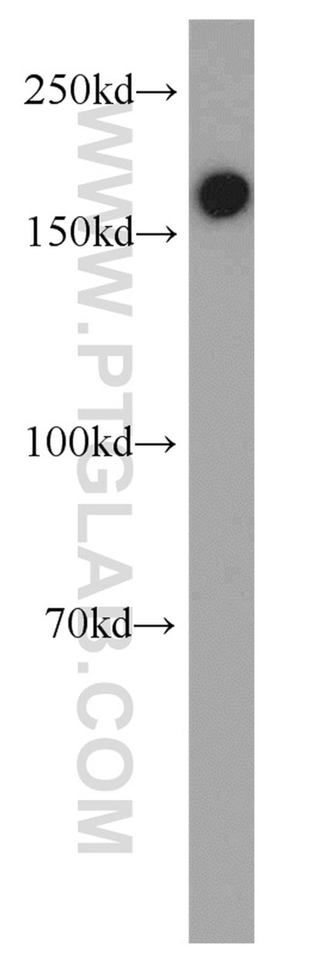 PDGFRB Antibody in Western Blot (WB)