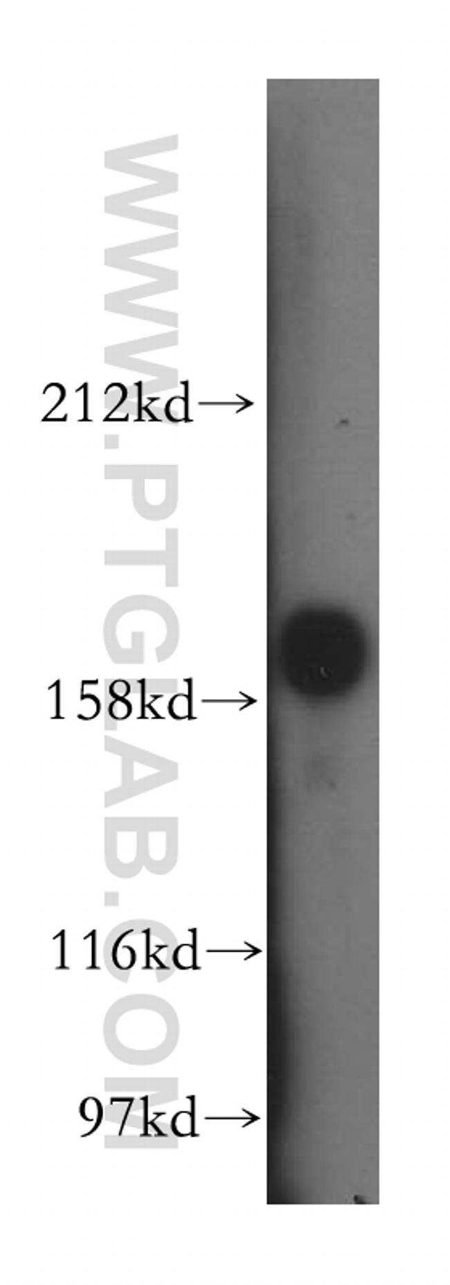 PDGFRB Antibody in Western Blot (WB)