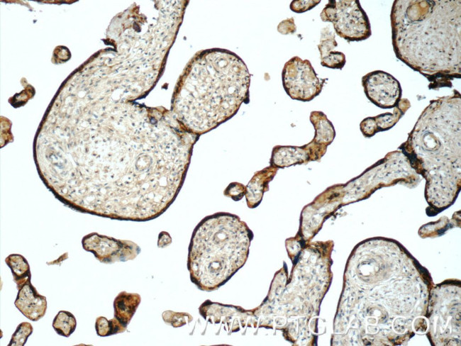 SIGLEC6 Antibody in Immunohistochemistry (Paraffin) (IHC (P))