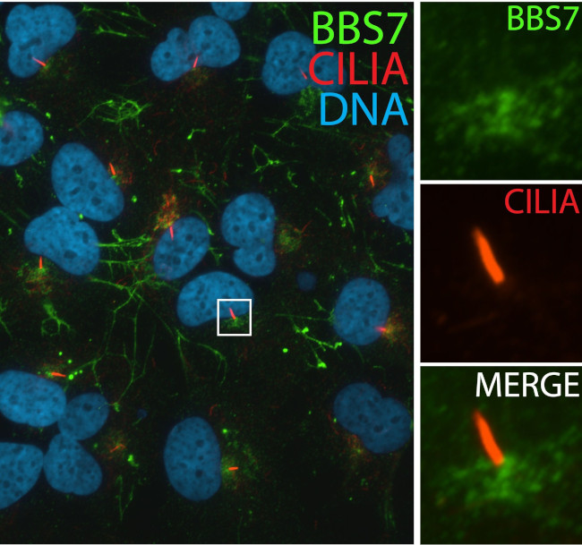 BBS7 Antibody in Immunocytochemistry (ICC/IF)