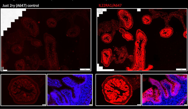 IL22RA1 Antibody in Immunocytochemistry (ICC/IF)