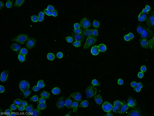 IL22RA1 Antibody in Immunocytochemistry (ICC/IF)