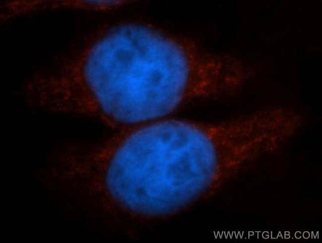 PER1 Antibody in Immunocytochemistry (ICC/IF)