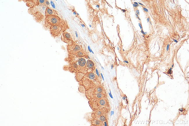 PER1 Antibody in Immunohistochemistry (Paraffin) (IHC (P))