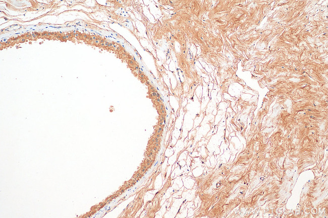 PER1 Antibody in Immunohistochemistry (Paraffin) (IHC (P))