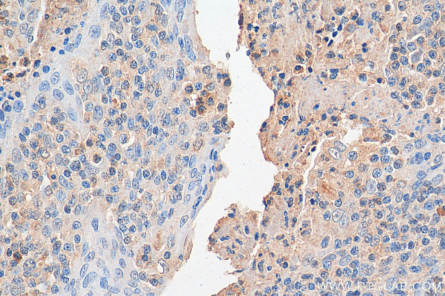 PER1 Antibody in Immunohistochemistry (Paraffin) (IHC (P))