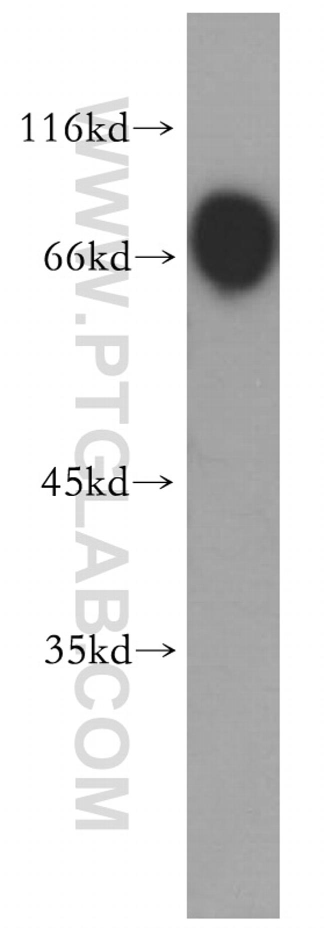 PER1 Antibody in Western Blot (WB)