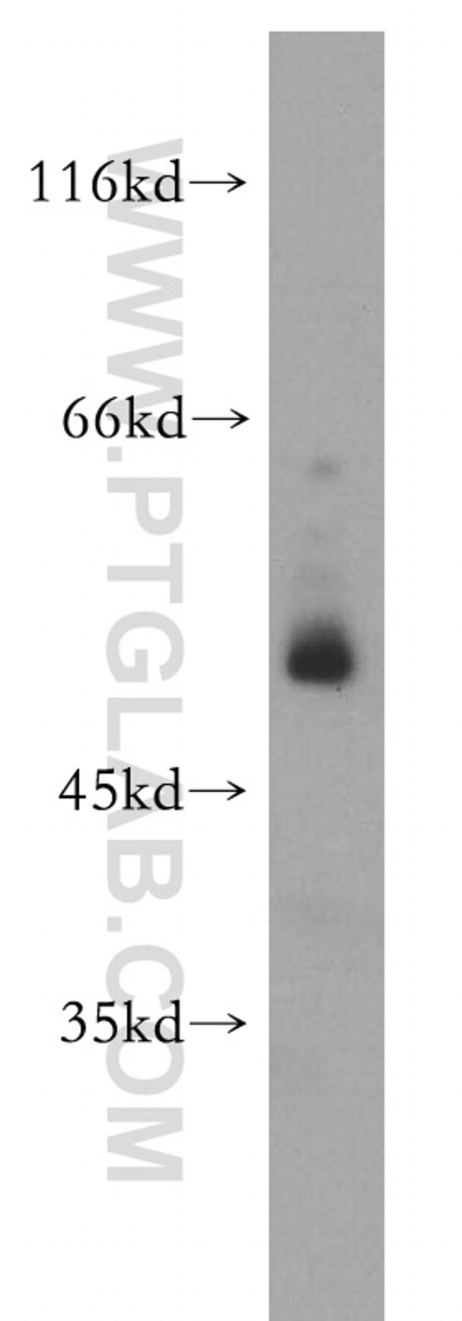 PER1 Antibody in Western Blot (WB)