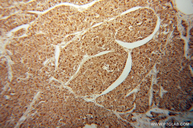 HIBADH Antibody in Immunohistochemistry (Paraffin) (IHC (P))