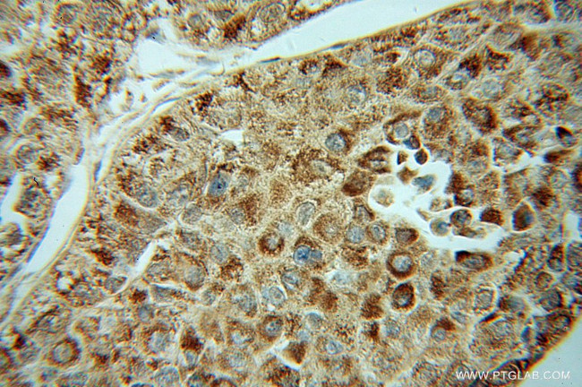 HIBADH Antibody in Immunohistochemistry (Paraffin) (IHC (P))