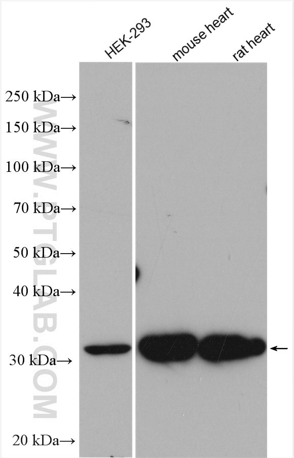 HIBADH Antibody in Western Blot (WB)