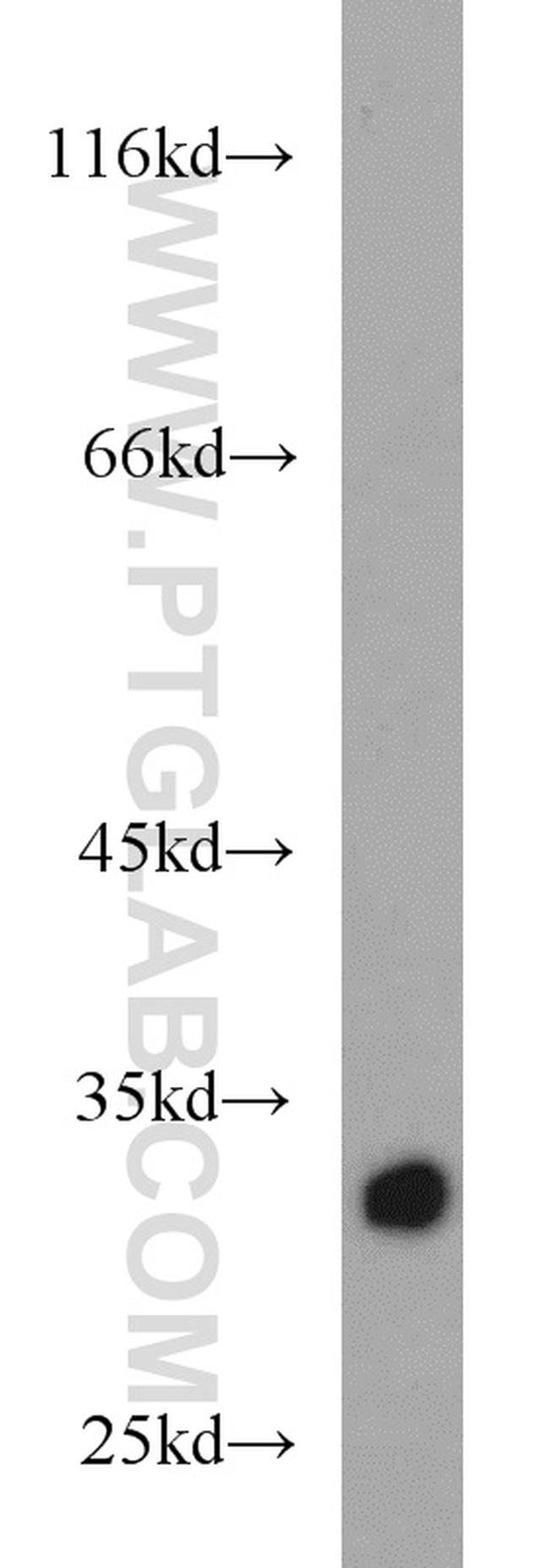 HIBADH Antibody in Western Blot (WB)