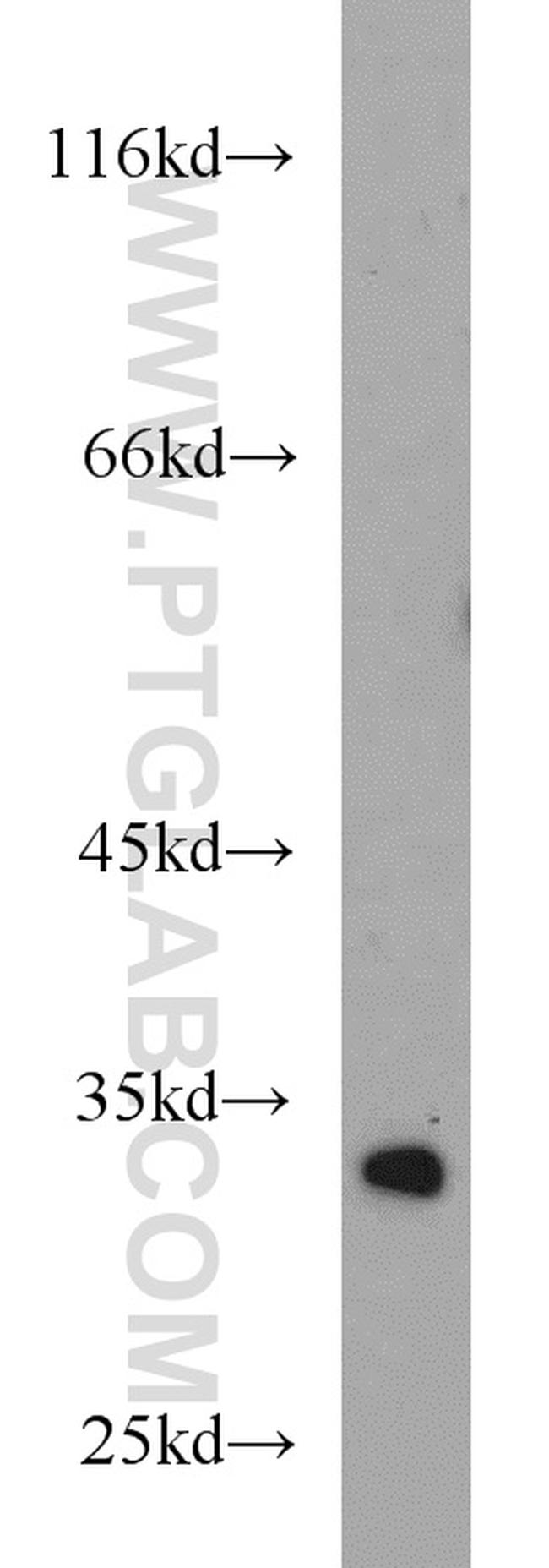 HIBADH Antibody in Western Blot (WB)