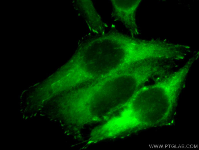 VASP Antibody in Immunocytochemistry (ICC/IF)