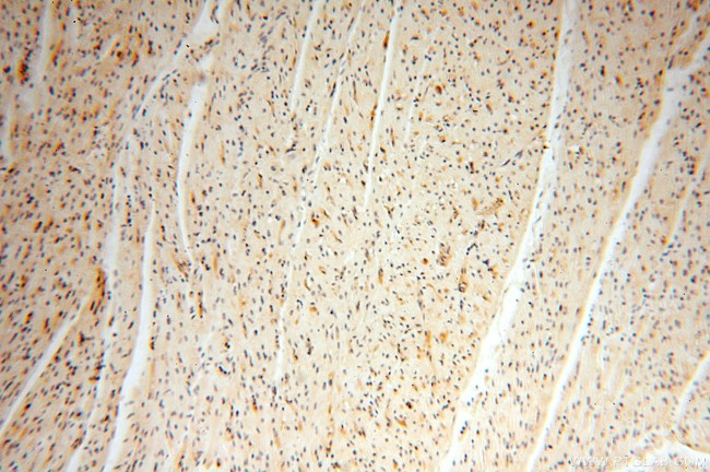 VASP Antibody in Immunohistochemistry (Paraffin) (IHC (P))